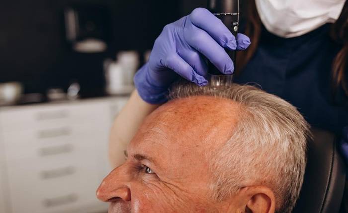 The Bald Truth: Your Complete Guide to Hims Hair Loss Treatment Screenshot 21